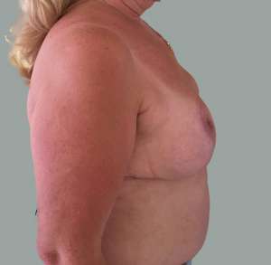 Reducere de sani 4 a