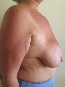 Reducere de sani 4 b