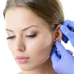 chirurgia urechii OTOPLASTITA